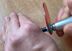 Utwardzanie kompozytu stomatologicznego.